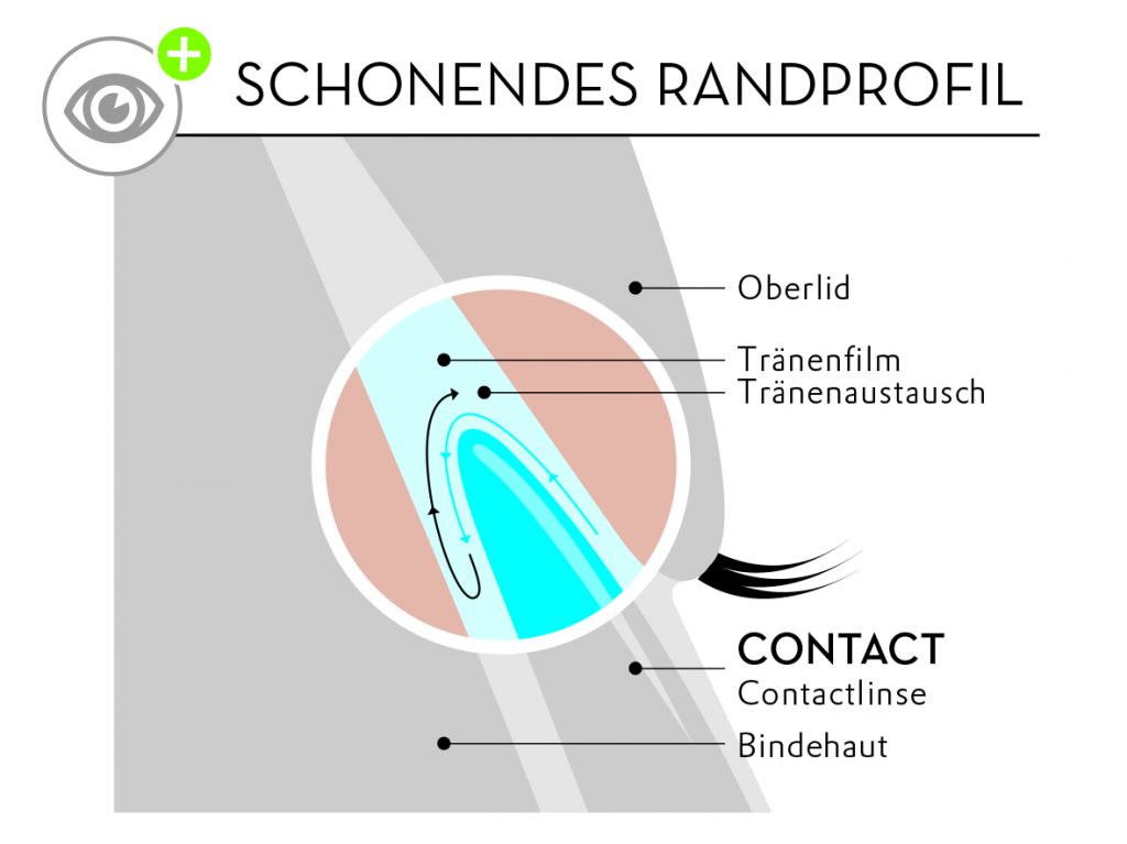 Schonendes Randprofil der Contact Individual Linsen von Wöhlk Contactlinsen