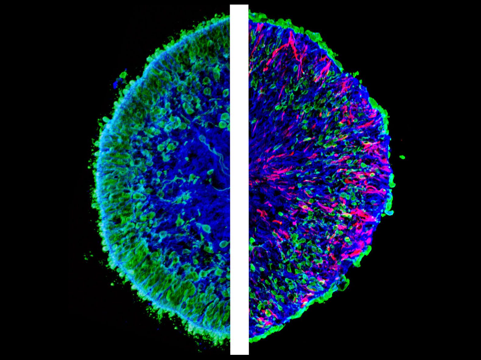 Mikroskopische Aufnahmen von im Labor gezüchteten Mini-Netzhäuten, sogenannten menschlichen Netzhaut-Organoiden