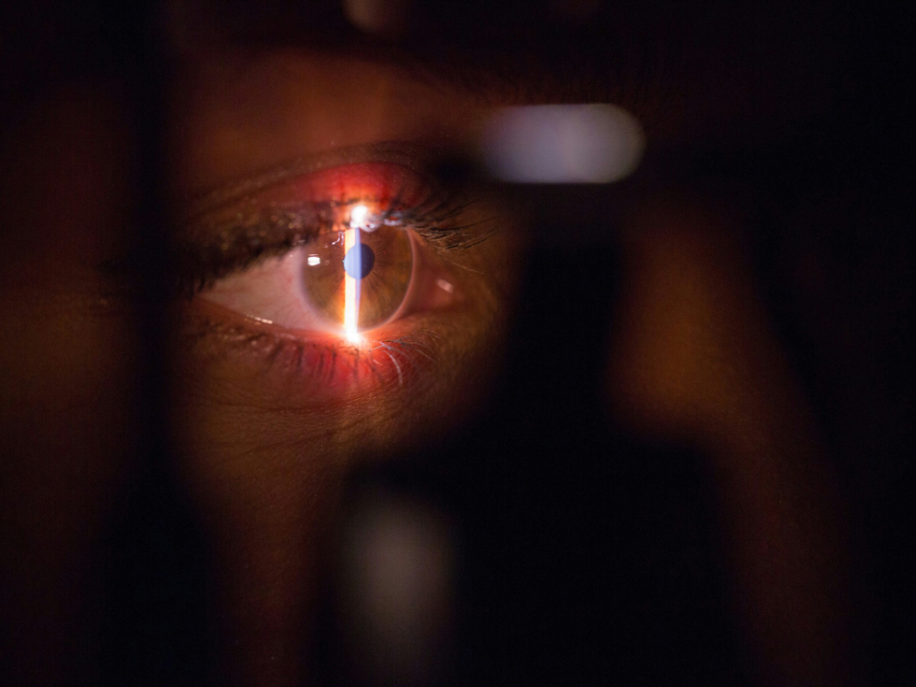Auge wird per Spaltlampe untersucht