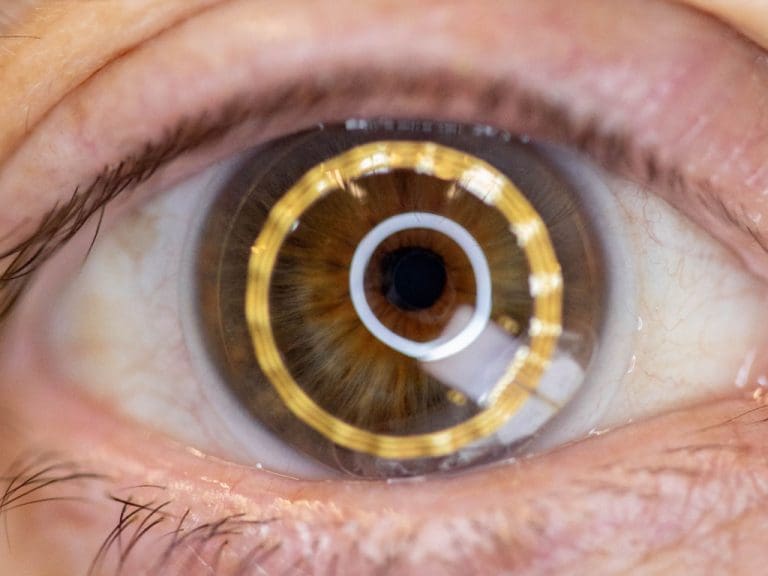 Arzneimittelabgabe über Kontaktlinsen